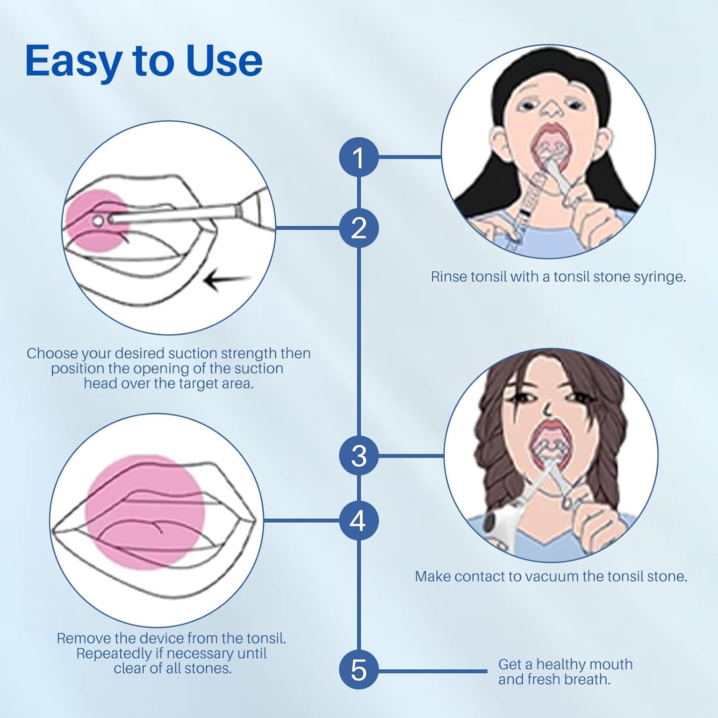 Best Pricer™ Electronic Tonsil Stone Remover Kit | 10-Piece Professional Set | Vacuum Suction Technology | 6 Suction Modes | LED Light | Dentist-Recommended Bad Breath Treatment